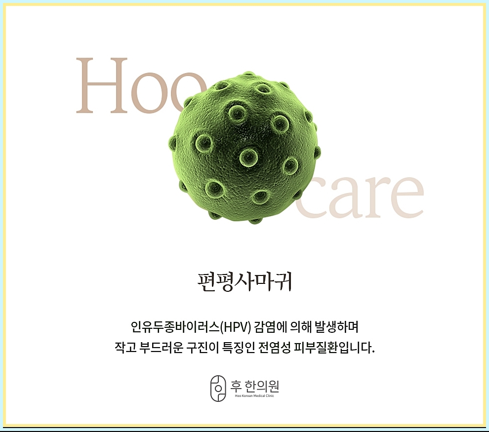 편평사마귀의 정의 이미지