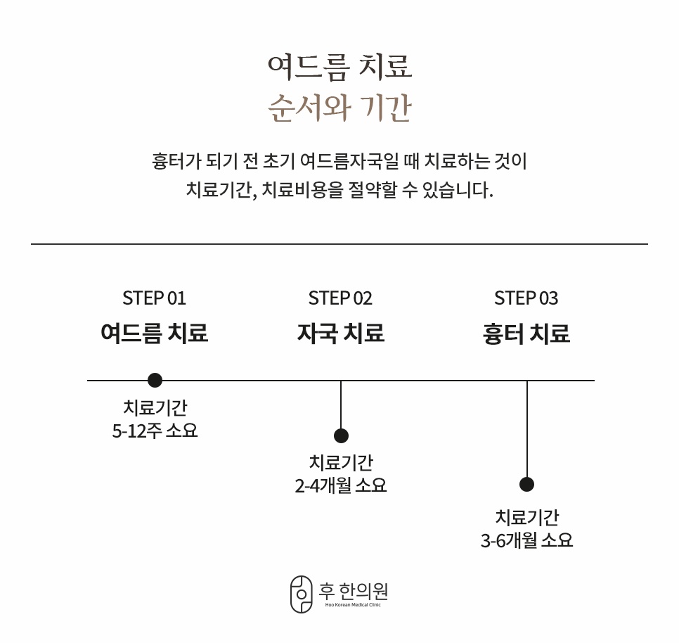 초기 여드름부터 자국, 흉터까지 단계별 치료 순서와 소요 기간 안내