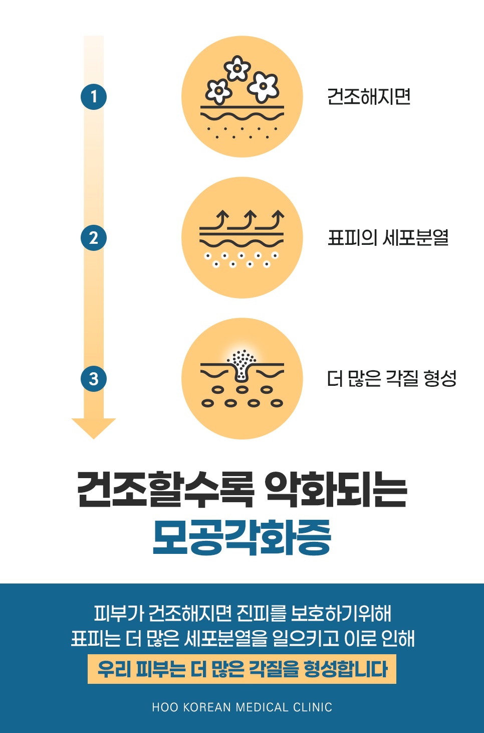 피부가 건조해지면 표피 세포분열이 늘어 각질이 더 쌓이는 3단계 악화 과정 일러스트