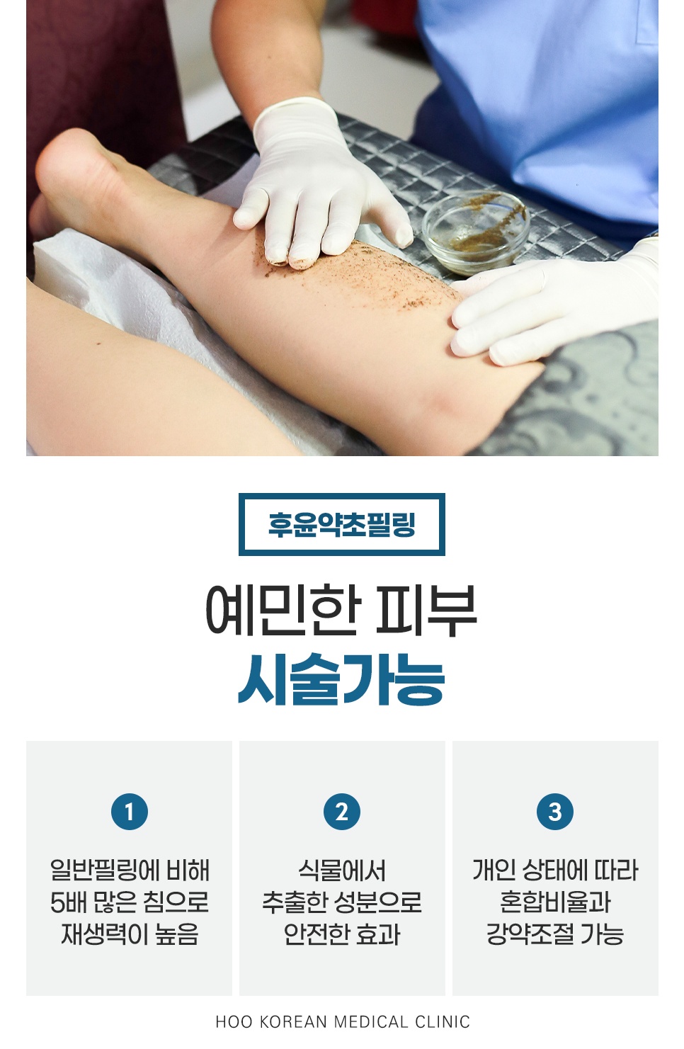일반 필링보다 침을 5배 많이 쓰고 혼합비율과 강약을 조절하는 종아리 후윤약초필링
