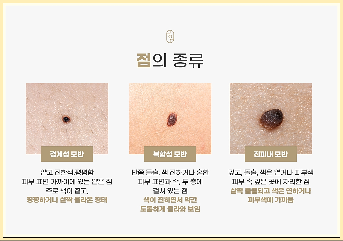 다양한 점의 종류 이미지