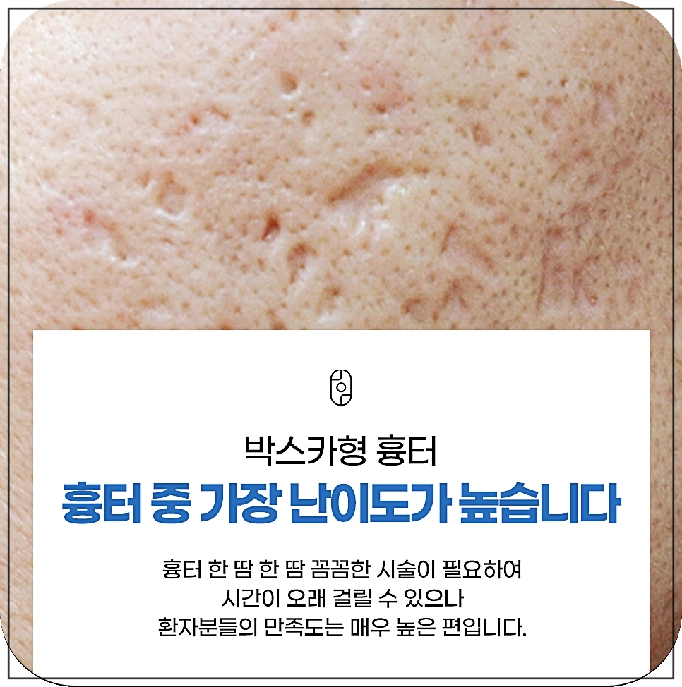 박스카형에 좋은 새살침