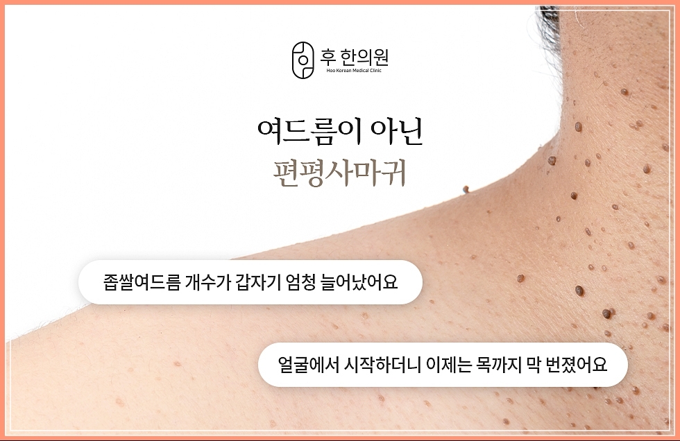 좁쌀여드름과 혼동되기 쉬운 편사